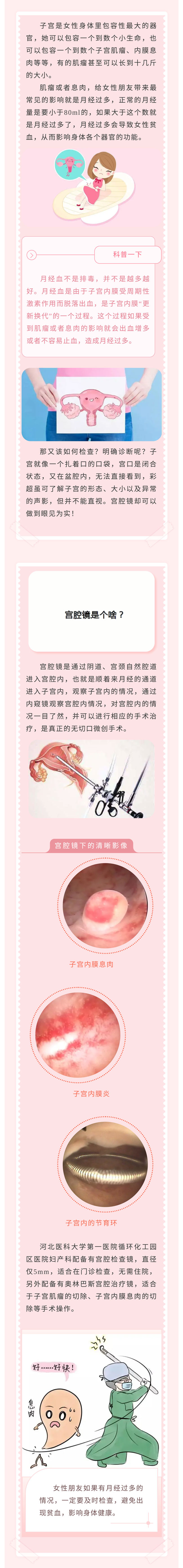 月經(jīng)量增多！怎么回事？——小小“宮腔鏡”，一探究竟！.jpg